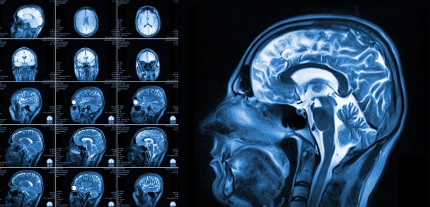 Digital communication brain scan - Psychologyof online love